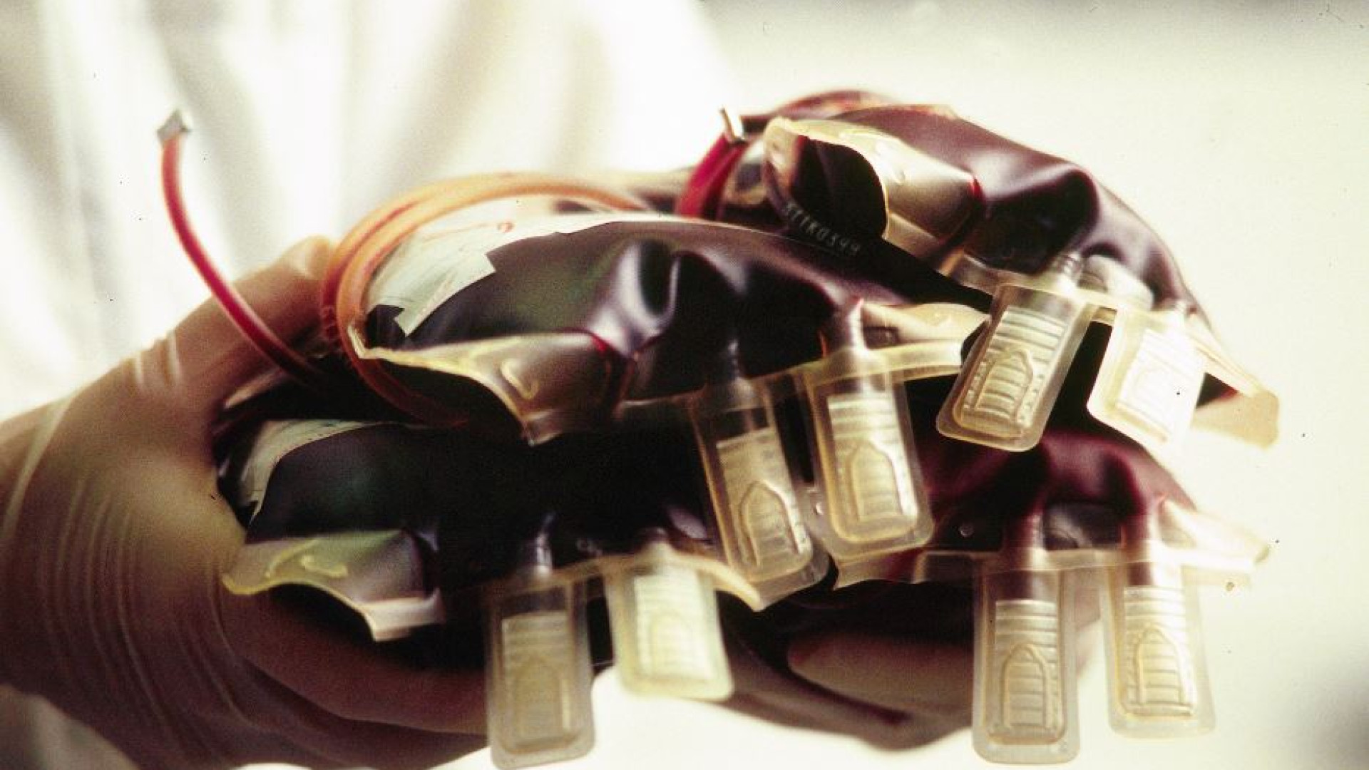 Immagine di Sempre più giovani donano sangue, ma mancano medici che lo raccolgano