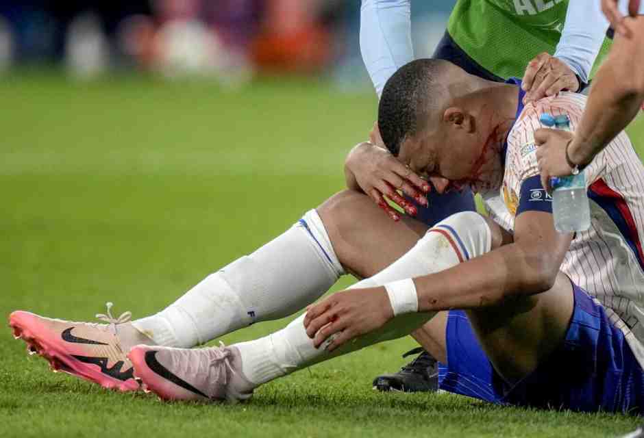 Kylian Mbappé si è rotto il setto nasale nella prima partita della Francia a Euro 2024 (foto Ap, via LaPresse)