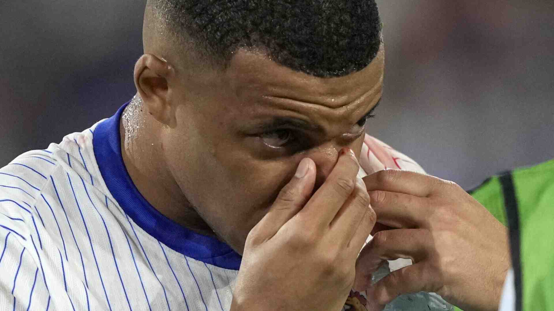 Immagine di Quel naso allegro da francese in gita di Mbappé è il primo memorabilia di Euro 2024