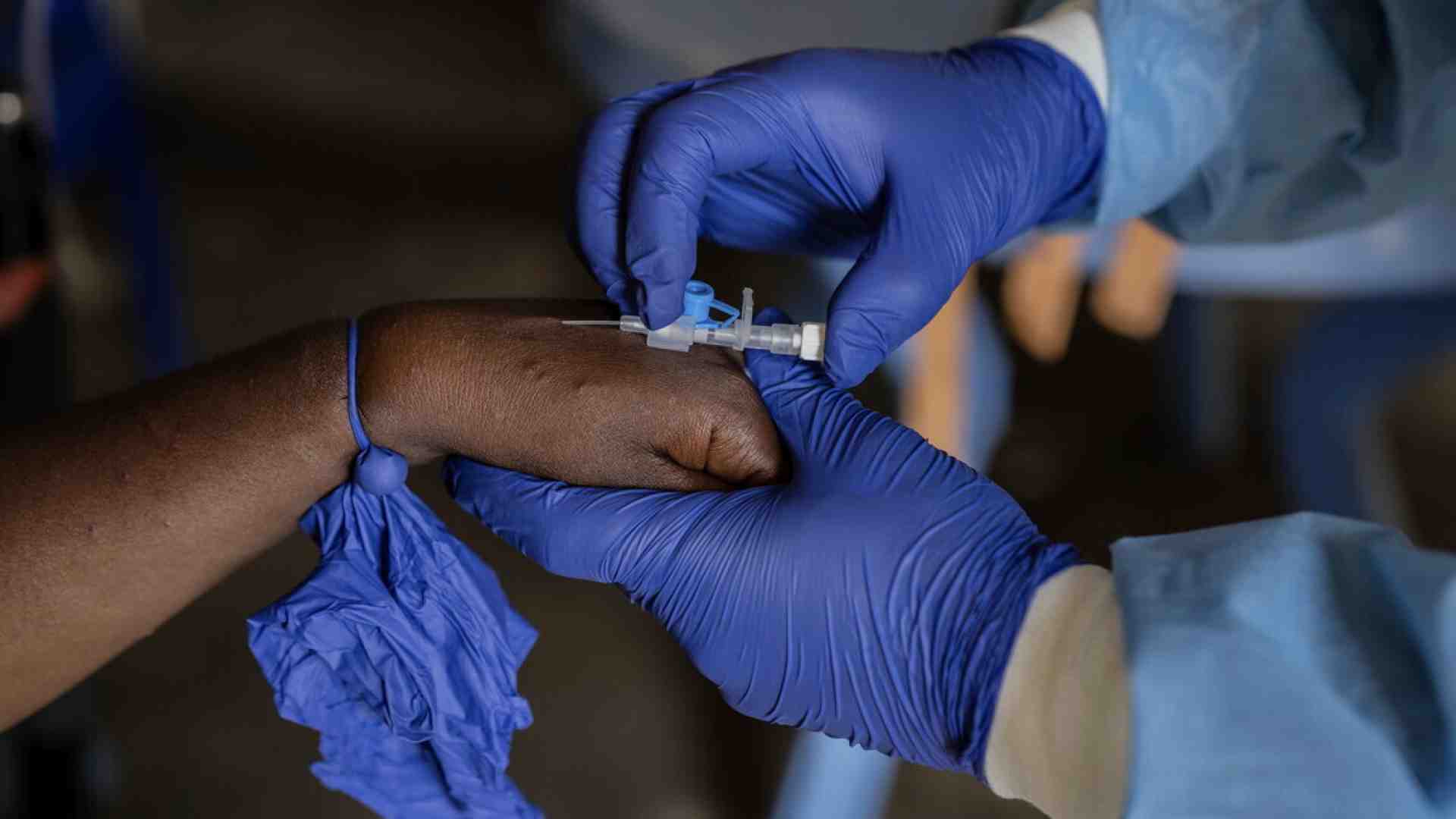 Immagine di Il nuovo virus Mpox e la strada per far arrivare i vaccini dove servono