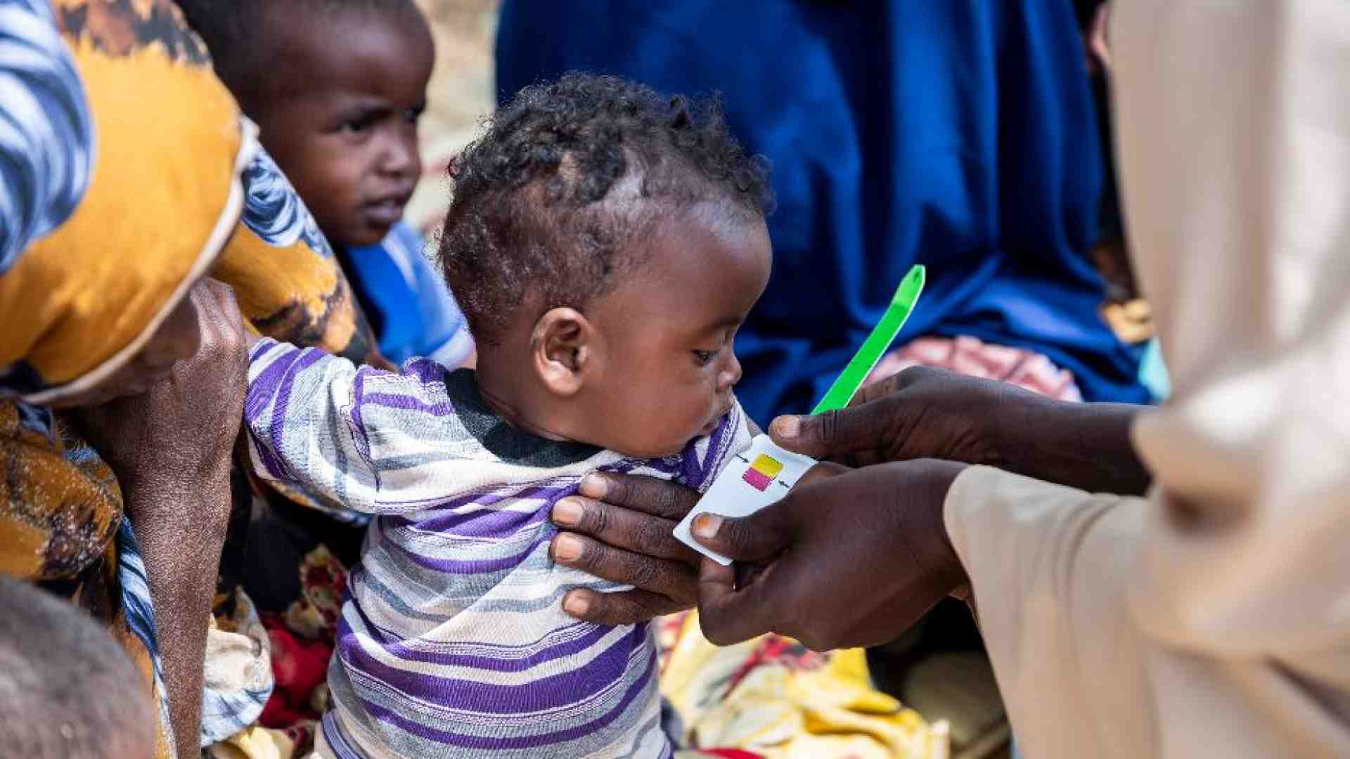 Immagine di Quando la fame mangia i bambini: denutriti 27 milioni nel 2022. A Gaza il 96%