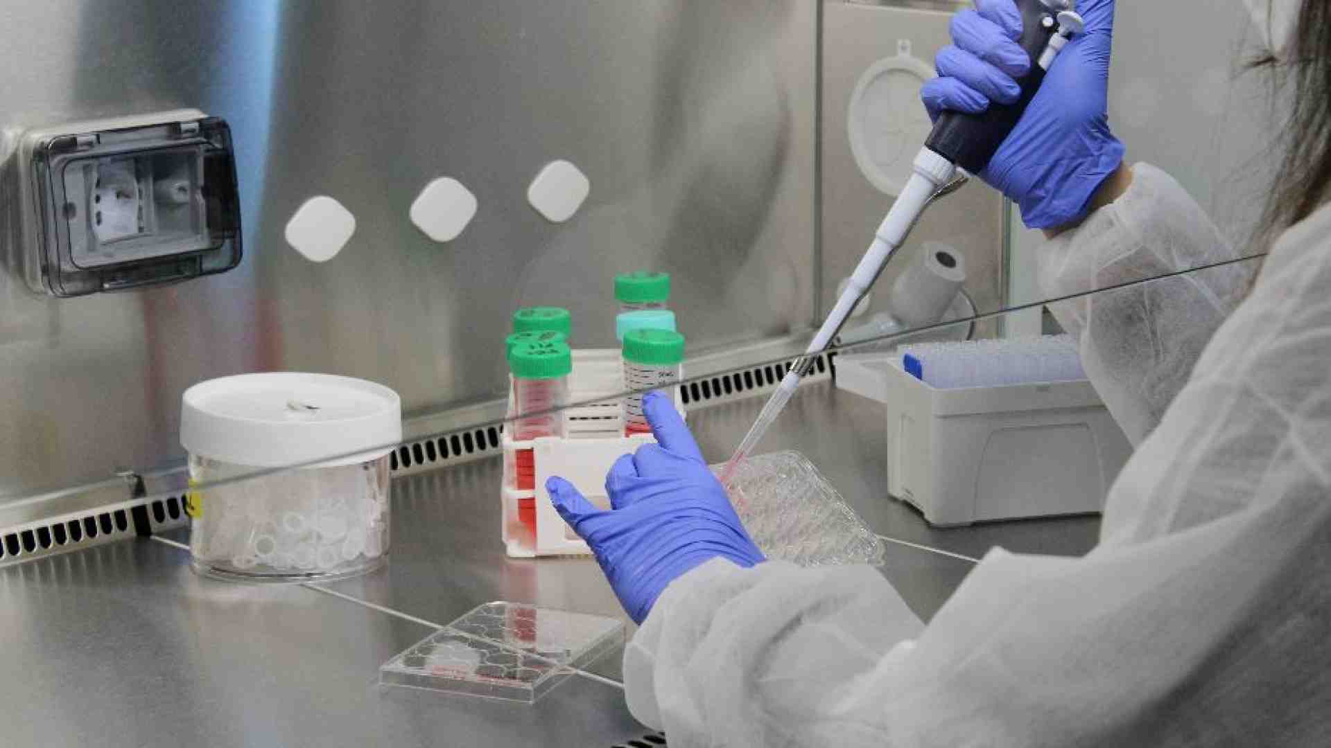 Immagine di Speranze di cura per la forma genetica più comune di Sla