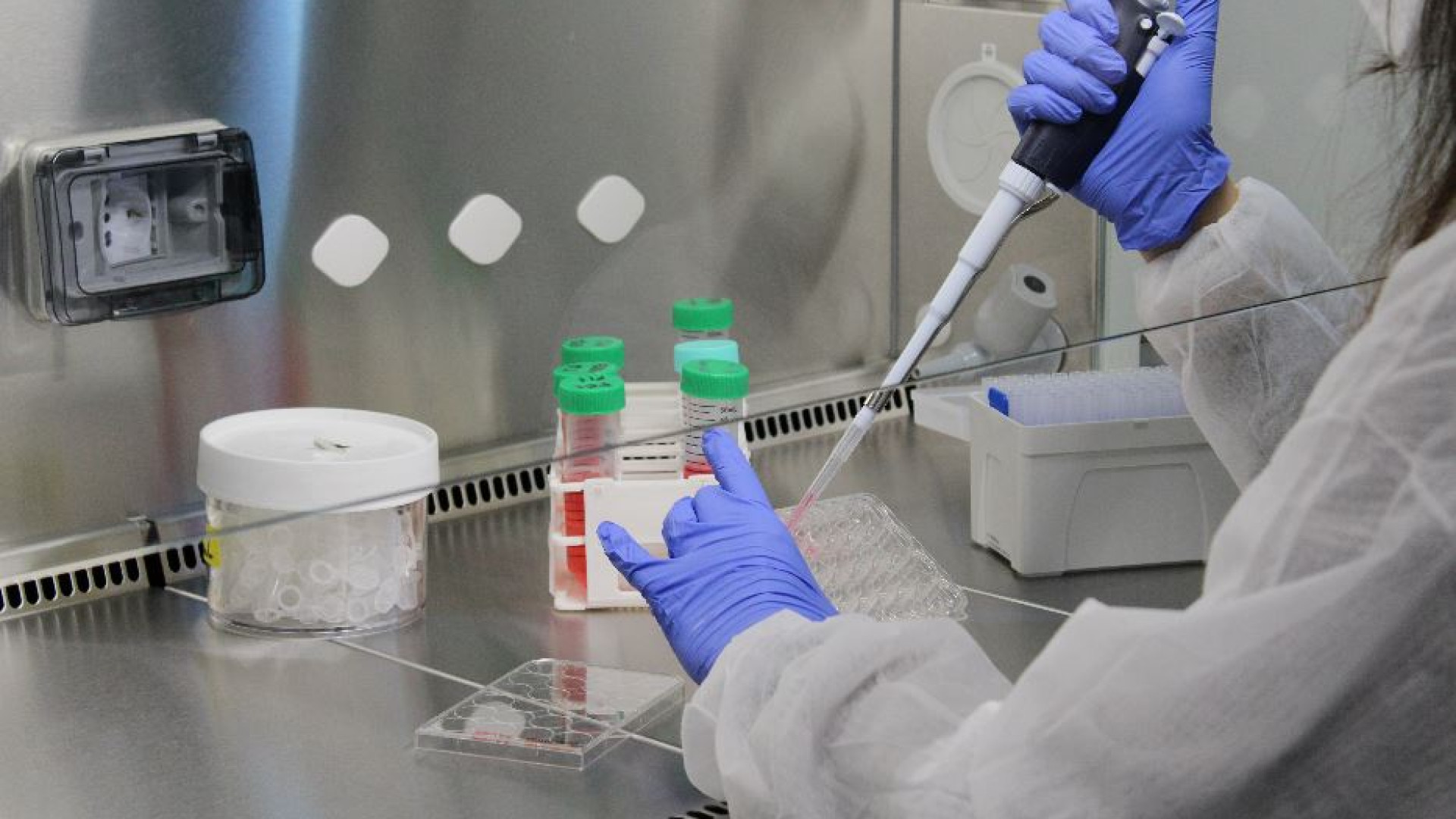 Immagine di Speranze di cura per la forma genetica più comune di Sla