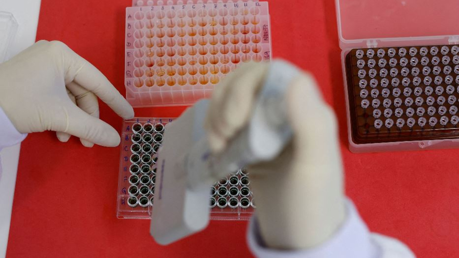 Immagine di In Congo una malattia sconosciuta uccide decine di persone