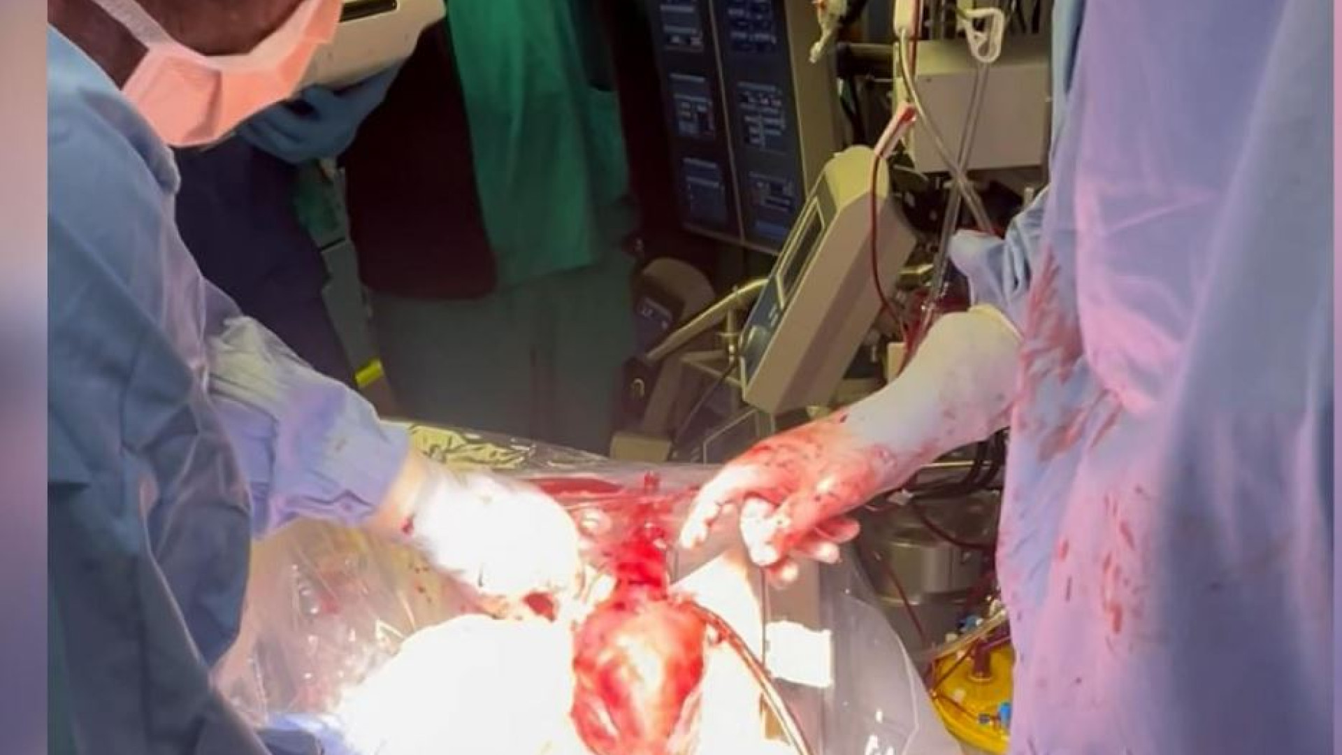 Immagine di Perché il trapianto “a cuore battente” non crea problemi etici
