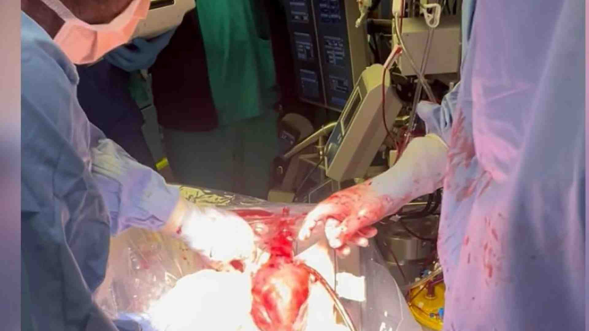 Immagine di Perché il trapianto “a cuore battente” non crea problemi etici