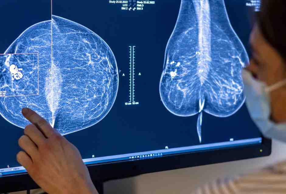 Berlino, il personale medico usa una mammografia per esaminare il seno di una donna (Foto di Michael Hanschke/Getty Images) <br />