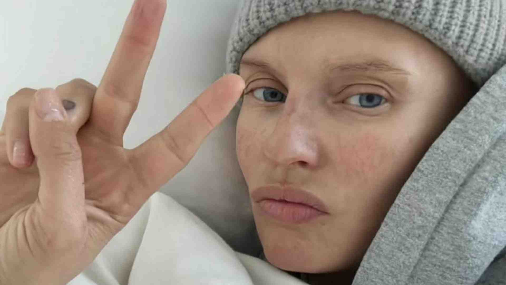 Immagine di Bianca Balti a Sanremo, la malattia raccontata col sorriso