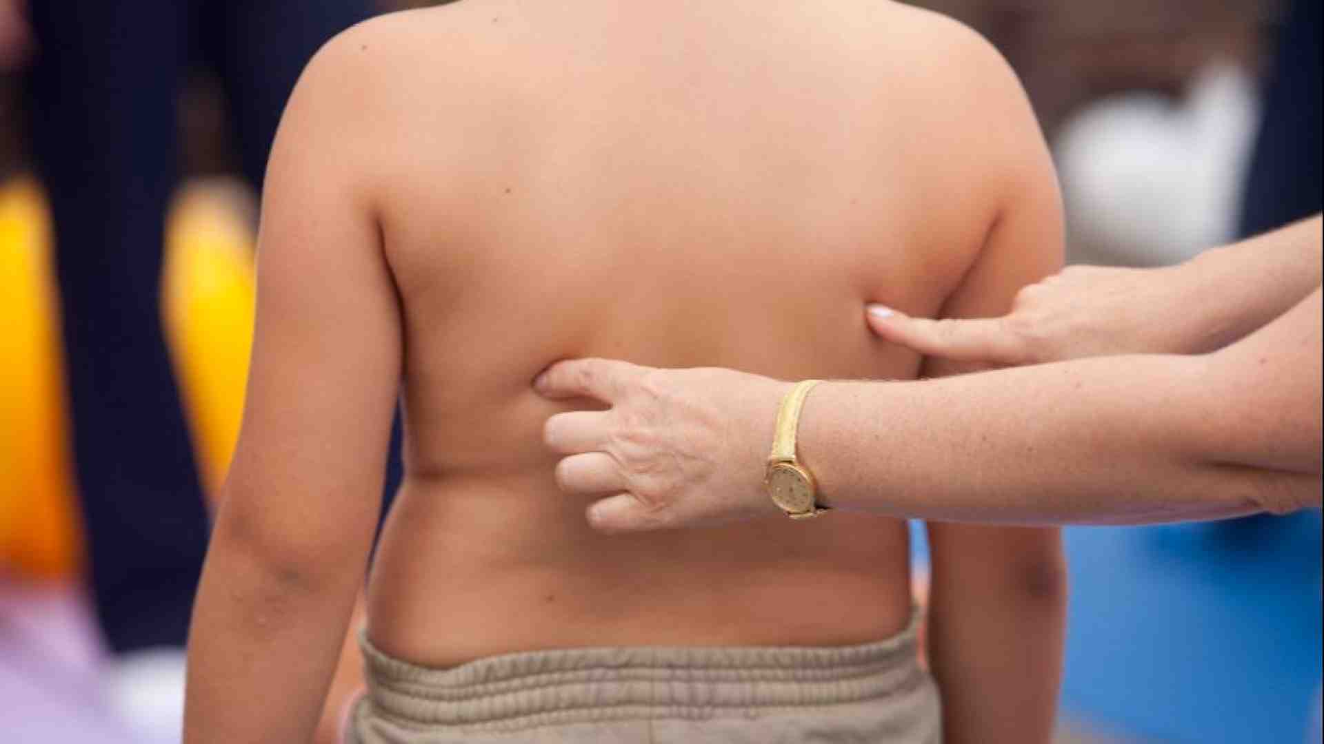 Immagine di Un bambino su 3 in eccesso di peso: troppo cibo e poco movimento