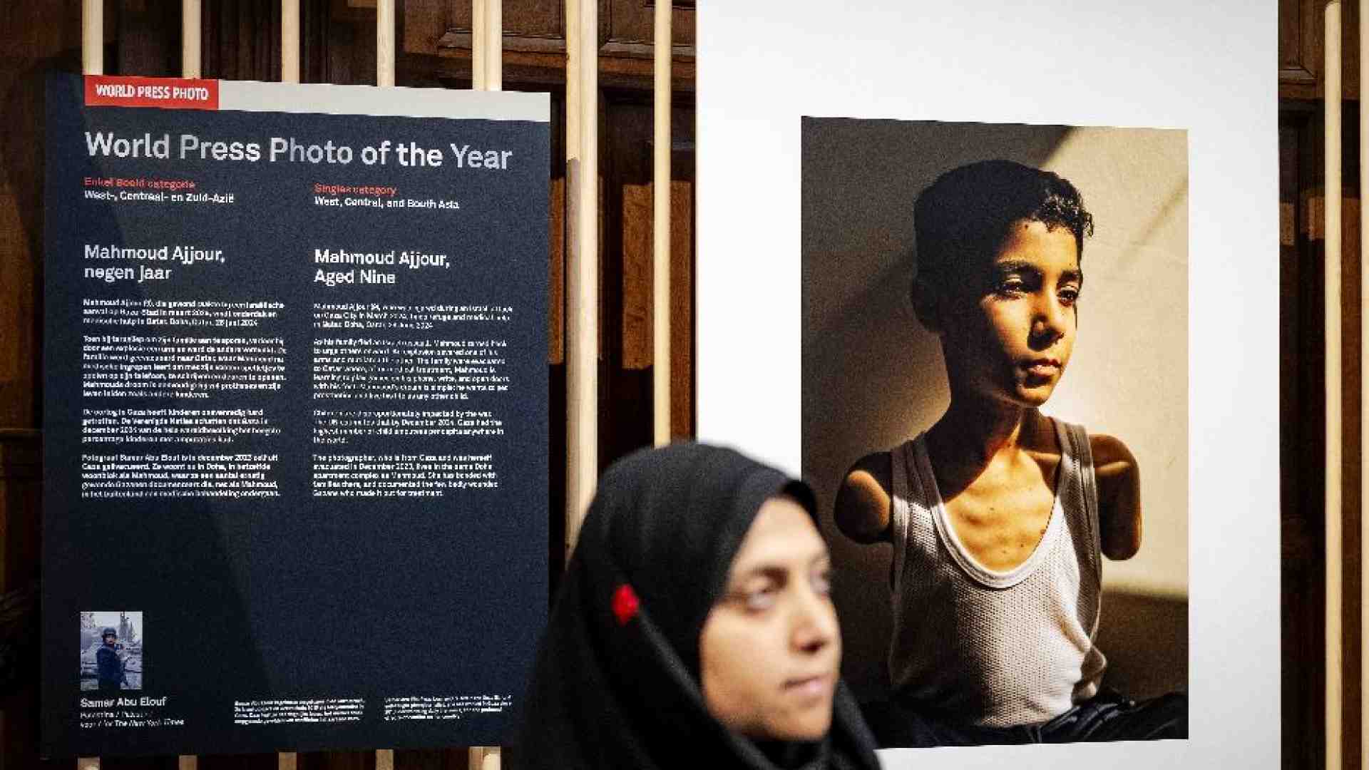 Immagine di Vince il World Press Photo l'immagine di un bimbo amputato di Gaza