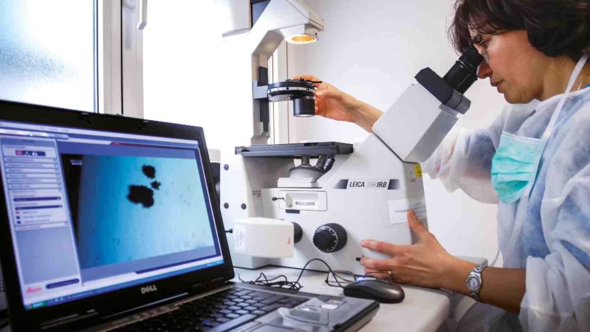 Immagine di I fumatori possono anticipare le mosse del cancro. Ecco come