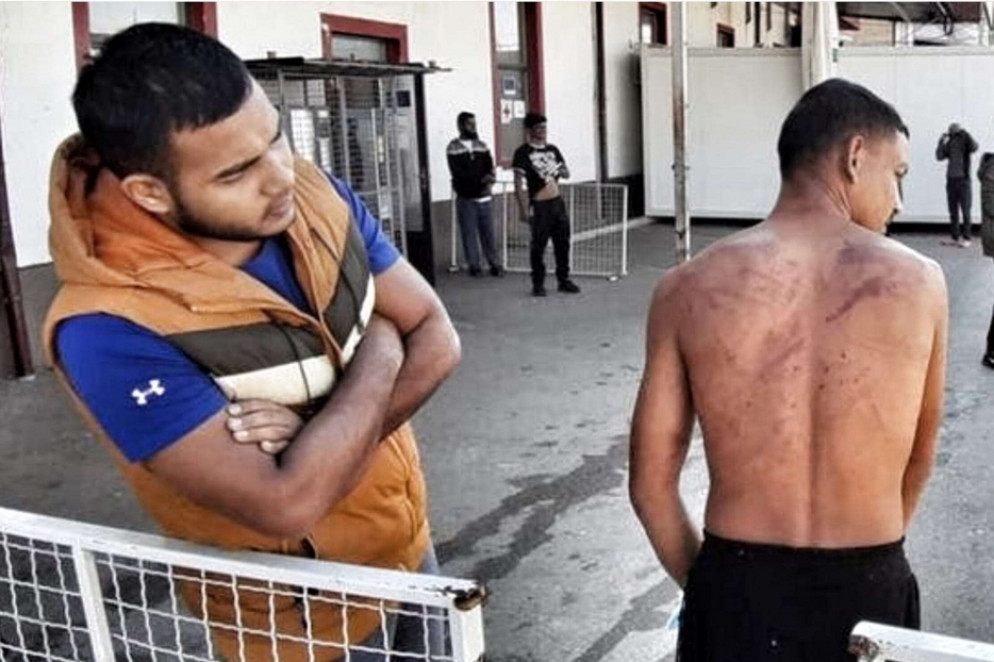 Un migrante con i segni delle percosse - .