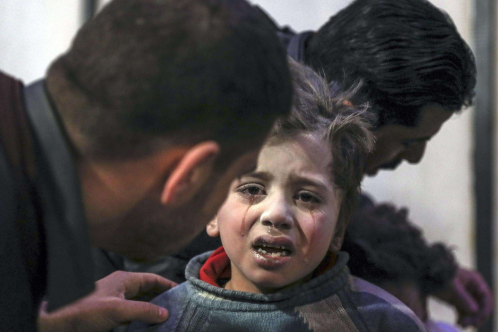Un bambino ferito viene curato all'ospedale di Douma, nell'est di Ghouta (Ansa)