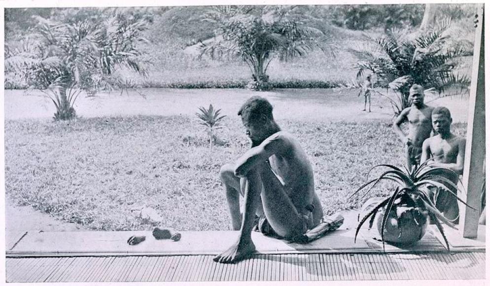Un uomo in Congo guarda la mano e il piede mozzati della figlia di cinque anni, 1904 - WikiMedia