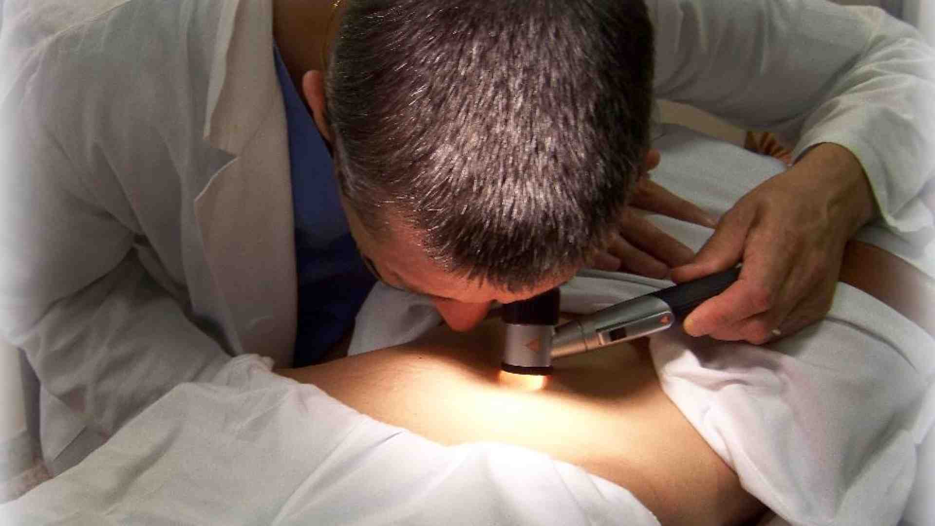 Immagine di Giovedì 19 a Roma screening dermatologici gratuiti