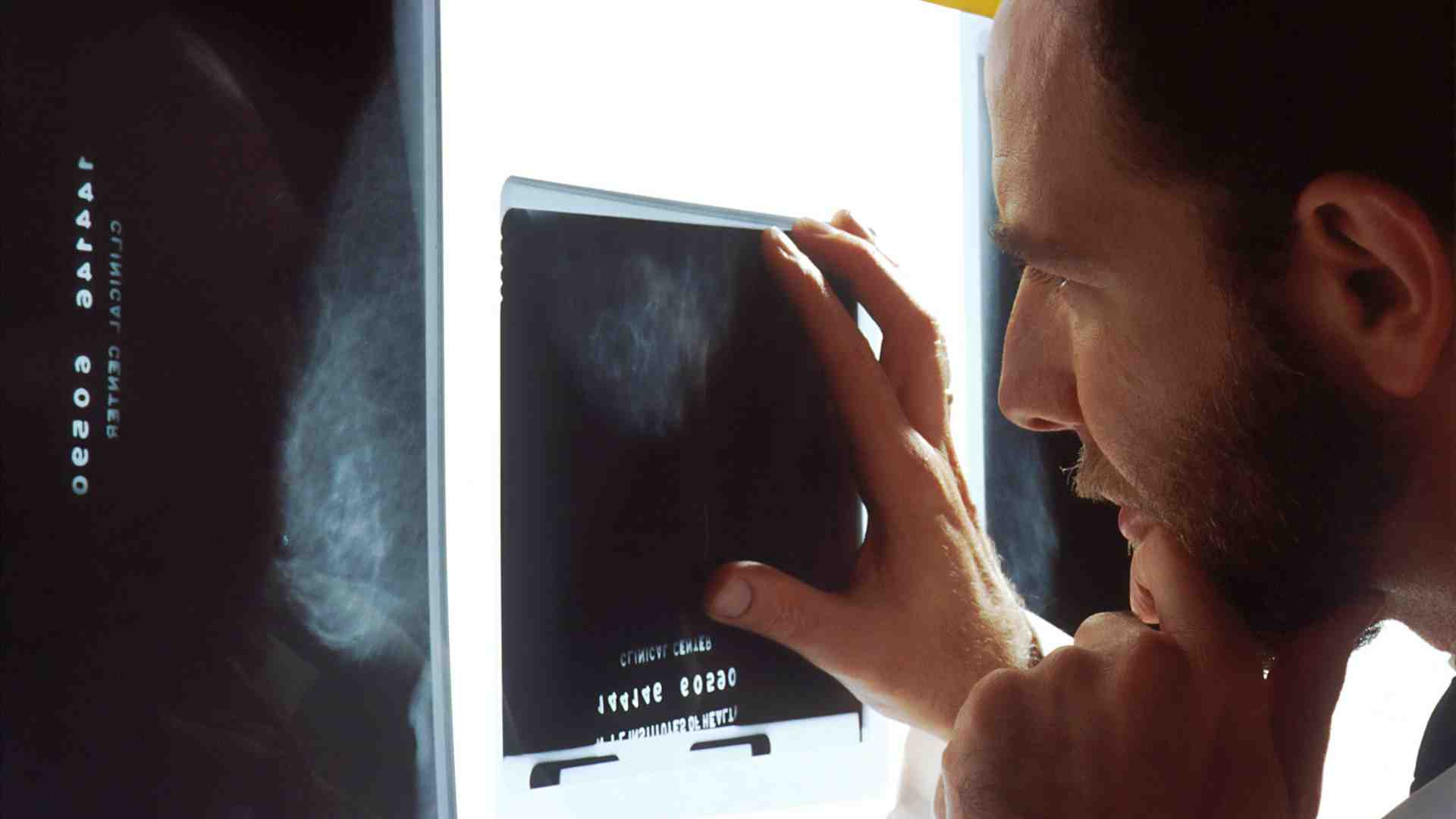 Immagine di Buone notizie sullo screening