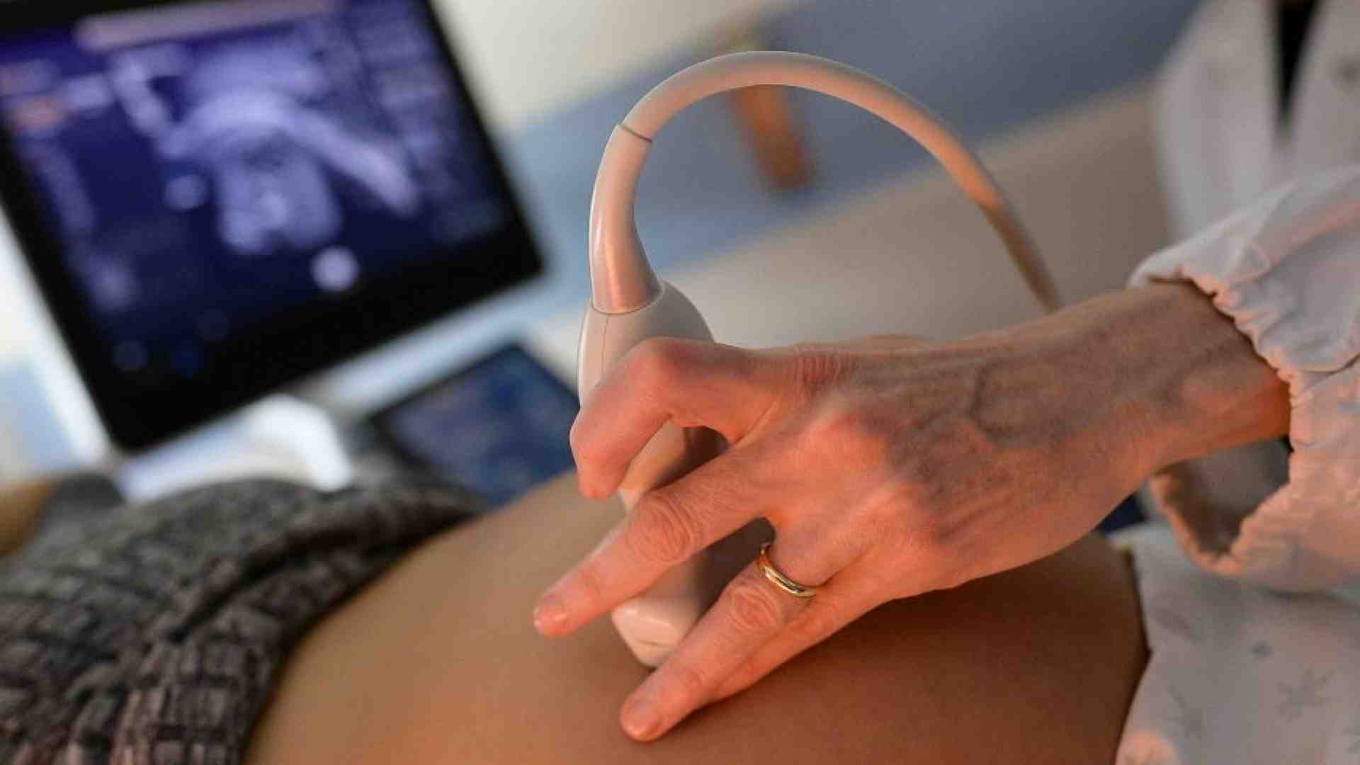 Immagine di Bimba con un tumore di 800 grammi salvata intevenendo prima e dopo la nascita
