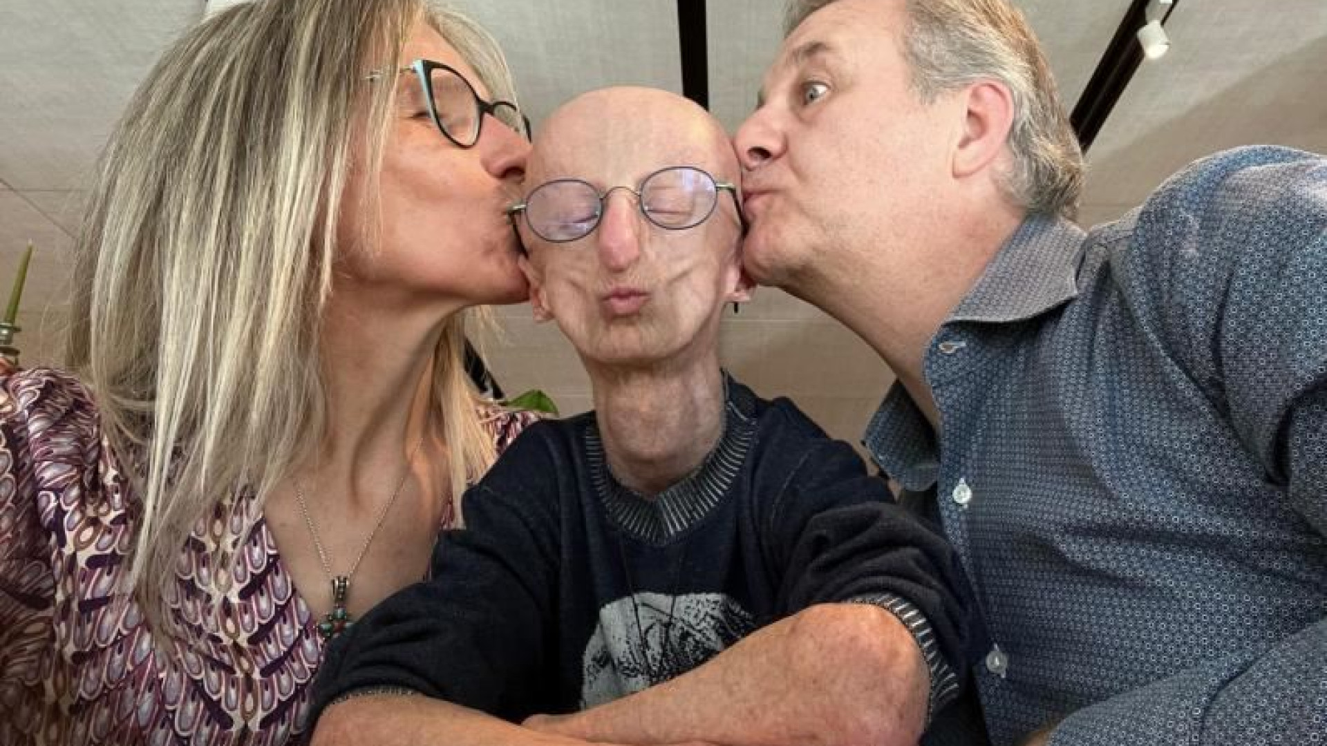 Immagine di I genitori di Sammy Basso: «Ci ha insegnato a vivere una vita piena»