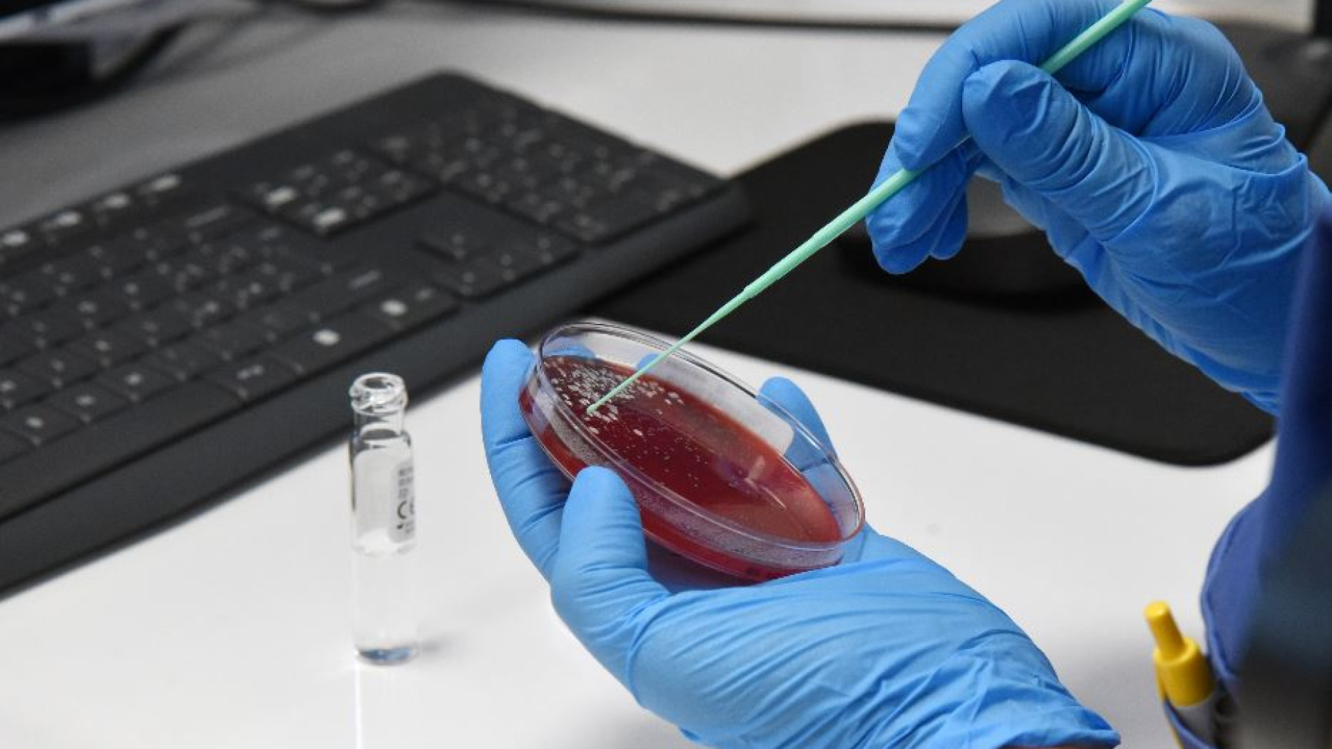 Immagine di Malattie rare, in Italia 100mila senza diagnosi