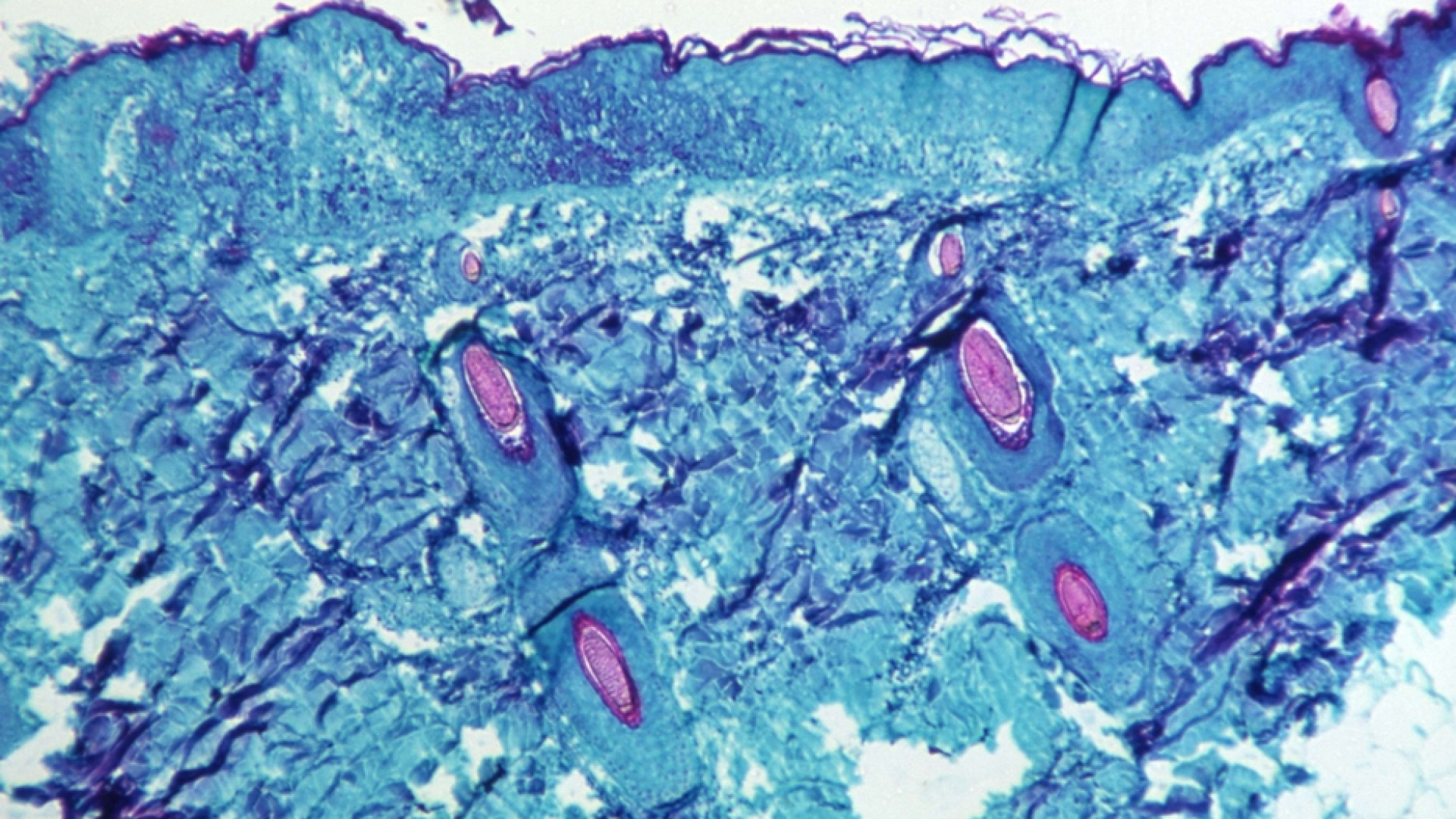Immagine di Anche in italia primi casi di virus delle scimmie. Gli esperti: niente allarmi
