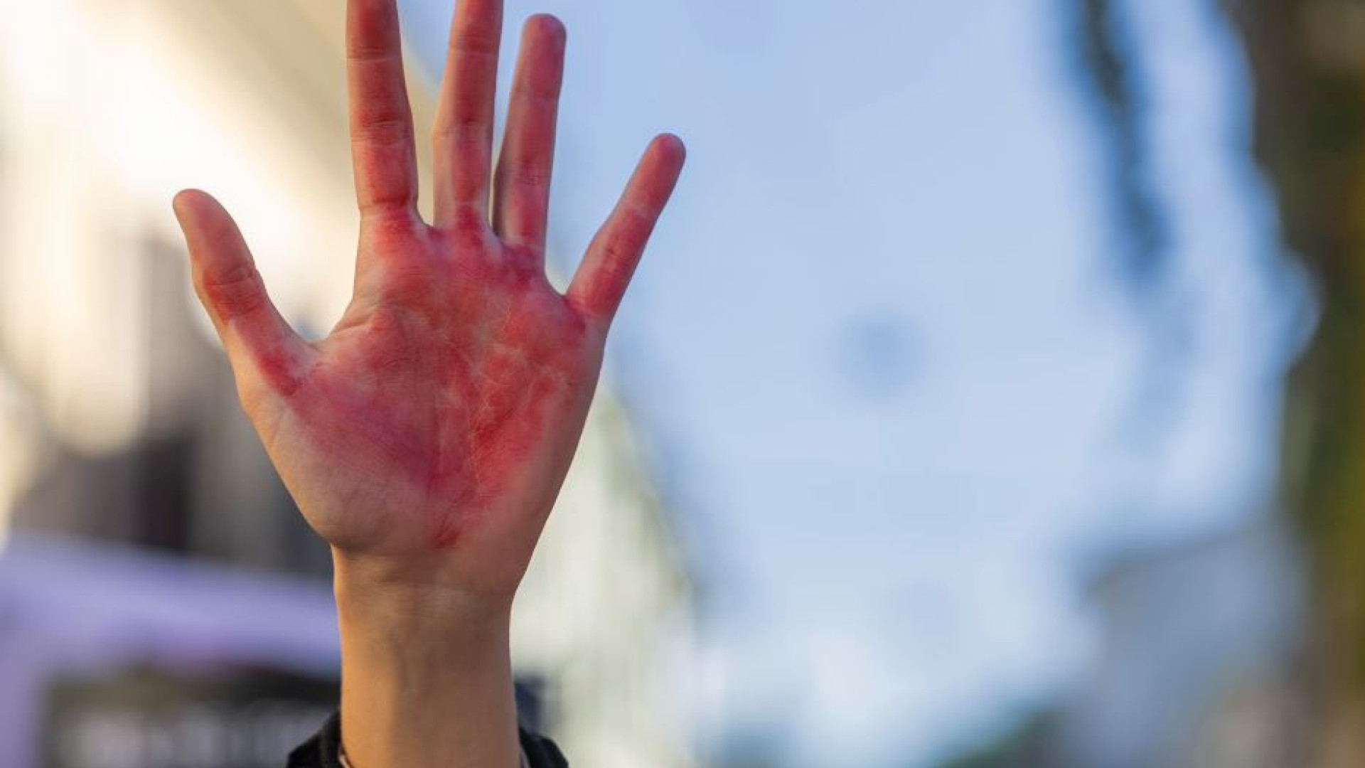 Immagine di Centri antiviolenza, niente fondi Pnrr. E al Sud saltano 80 progetti