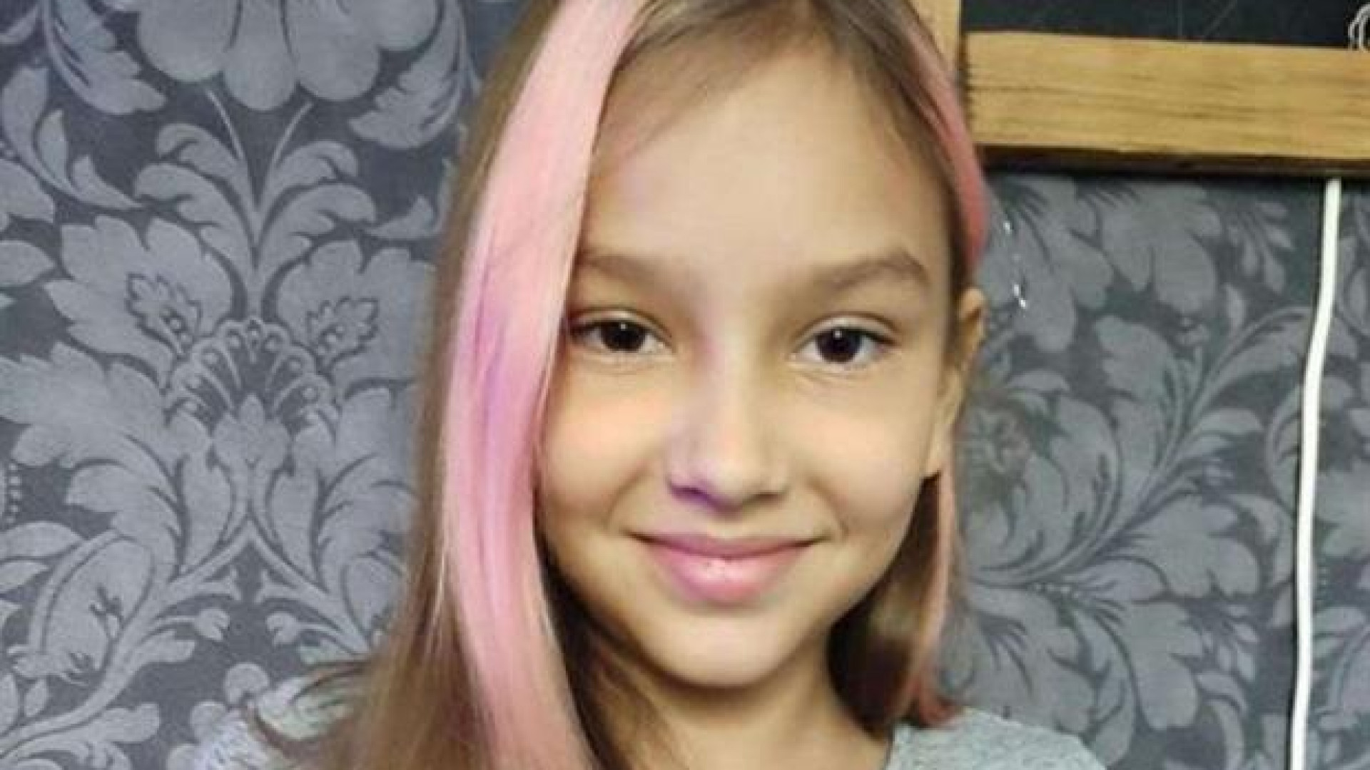 Immagine di Al San Raffaele di Roma la sorella di Polina, è semiparalizzata