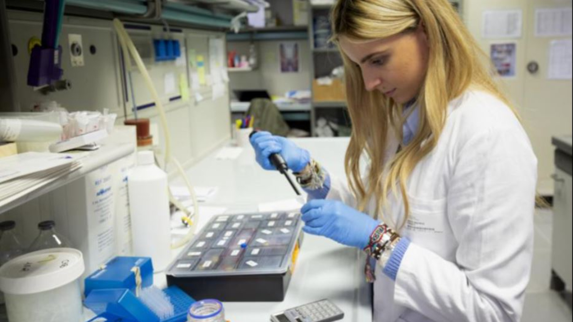 Immagine di “Linfociti killer” per curare i tumori al pancreas e al colon