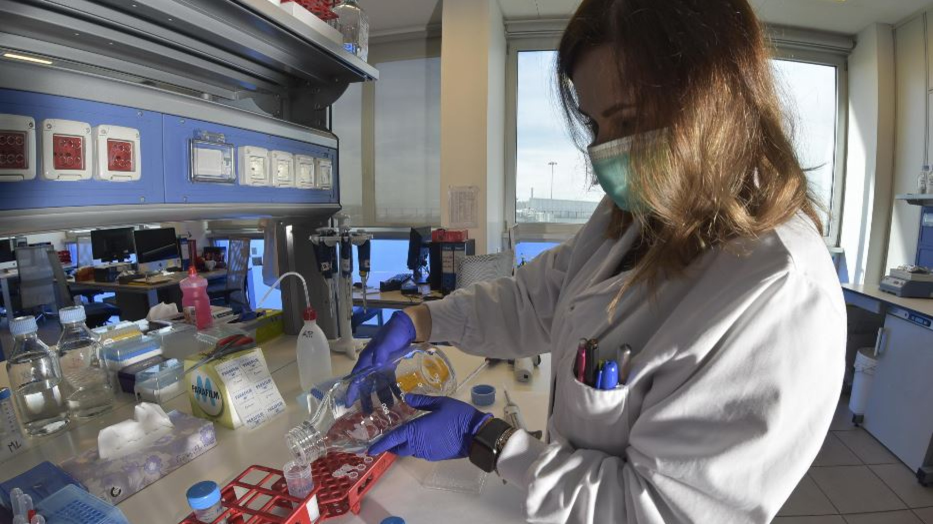 Immagine di Neuroscienziati italiani scoprono un nuovo gene che scatena l'Alzheimer