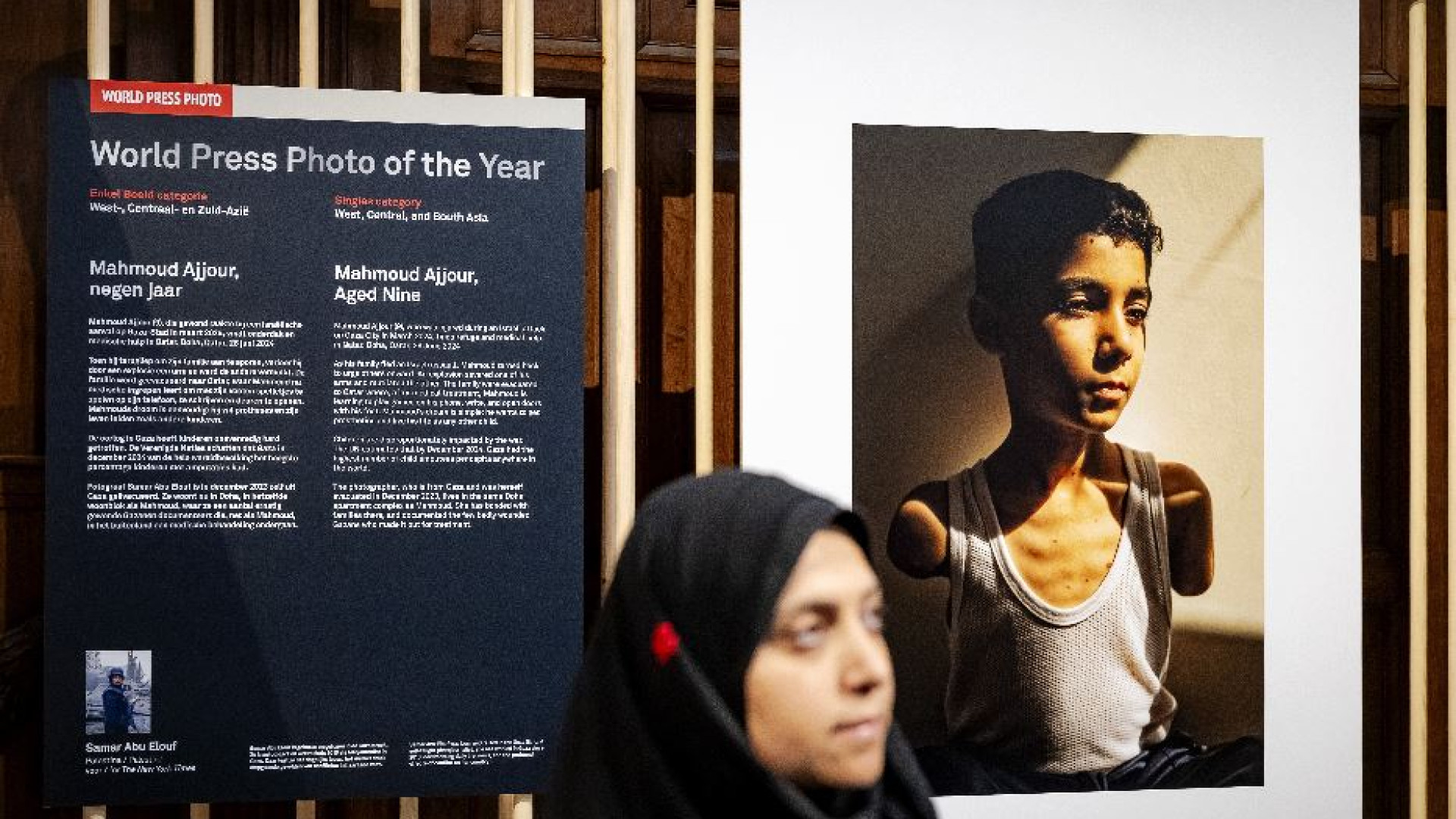 Immagine di Vince il World Press Photo l'immagine di un bimbo amputato di Gaza