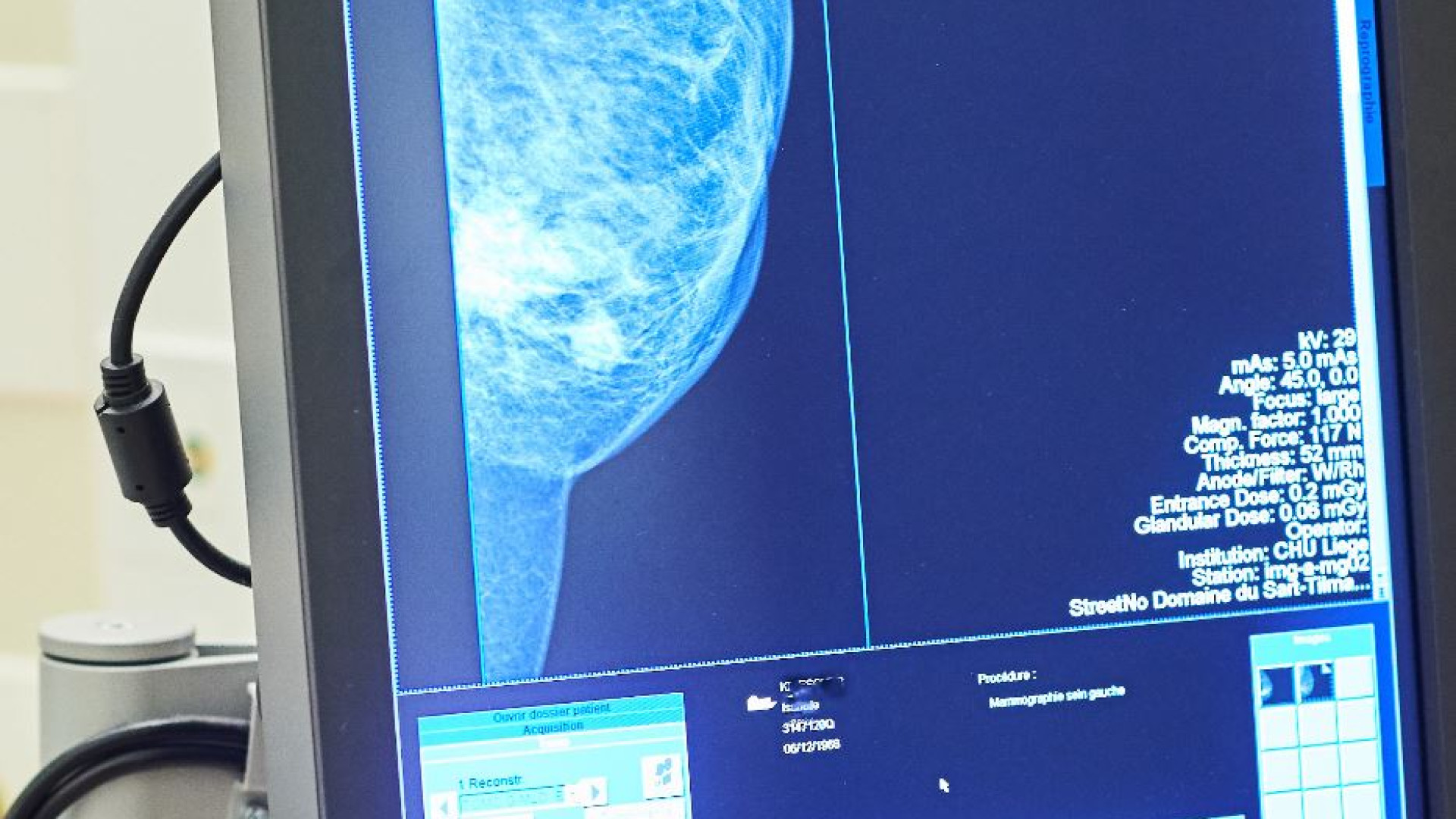 Immagine di Nelle nuove prestazioni sanitarie più esami preventivi per i tumori