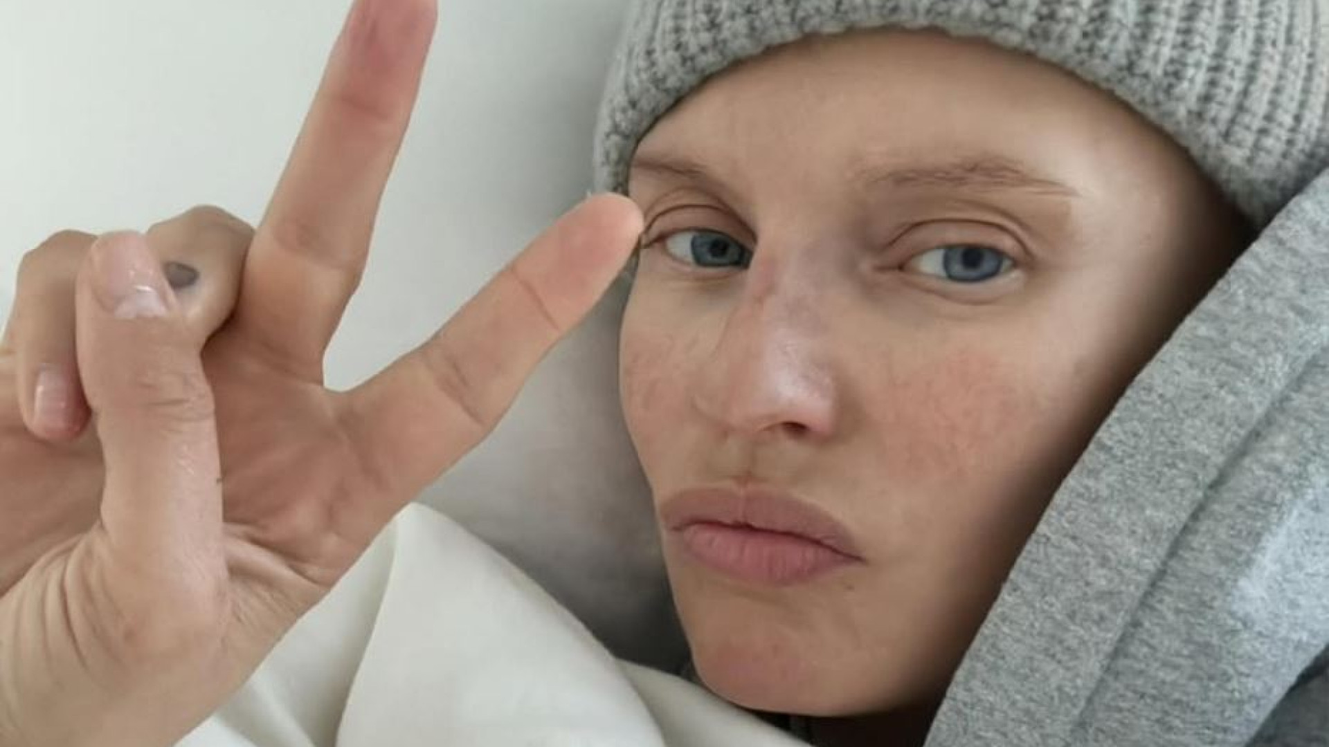 Immagine di Bianca Balti a Sanremo, la malattia raccontata col sorriso